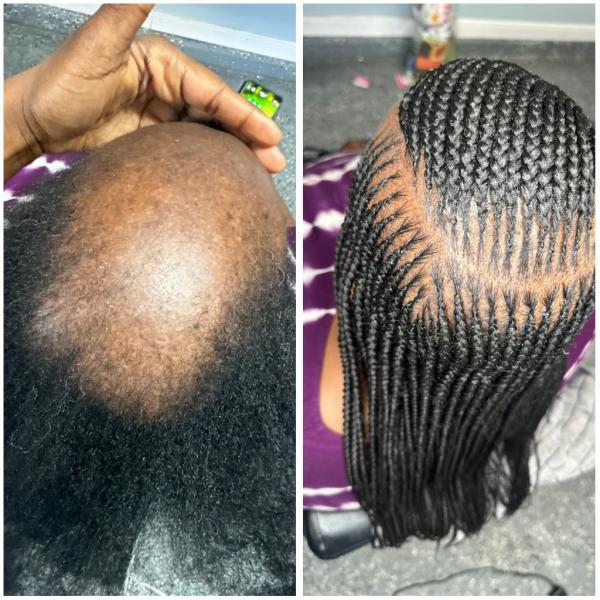 Hair growth oil , Shampoo, anti dandruff cream